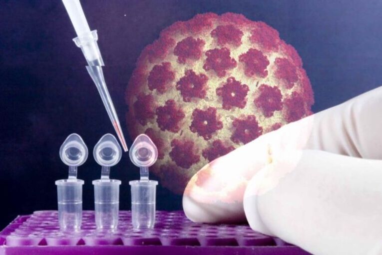 HPV tesztek